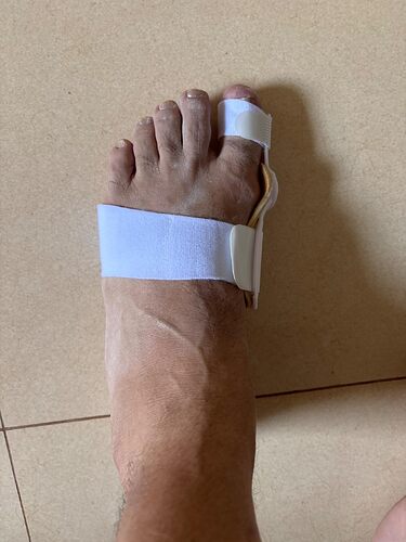 Corretor noturno de joanete visto de cima, preso ao pé com faixa larga e ajuste no dedão